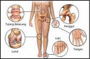 Penyakit Rematik  dan Pengobatannya