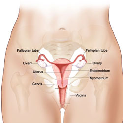 Penyebab dan Pencegahan Kanker Rahim Wanita