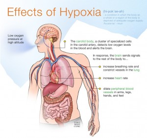 Cara Mengatasi Hypoxia